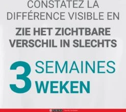 Purina ONE Junior - Kip/Granen - Kattenvoer - 800 G -Winkel Voor Kattenbenodigdheden 1200x1063